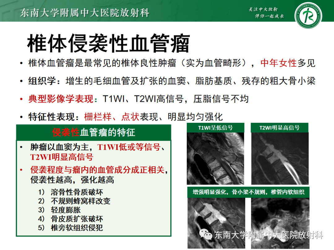 影像PPT - 【PPT】椎管内硬膜外间隙病变-28