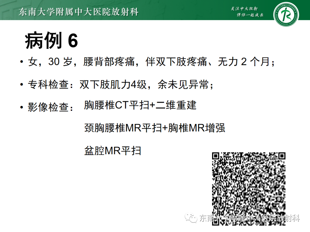 影像PPT - 【PPT】椎管内硬膜外间隙病变-30