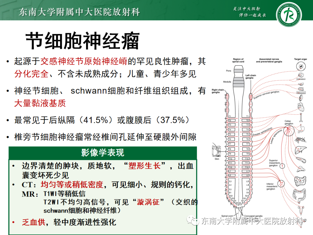 影像PPT - 【PPT】椎管内硬膜外间隙病变-39