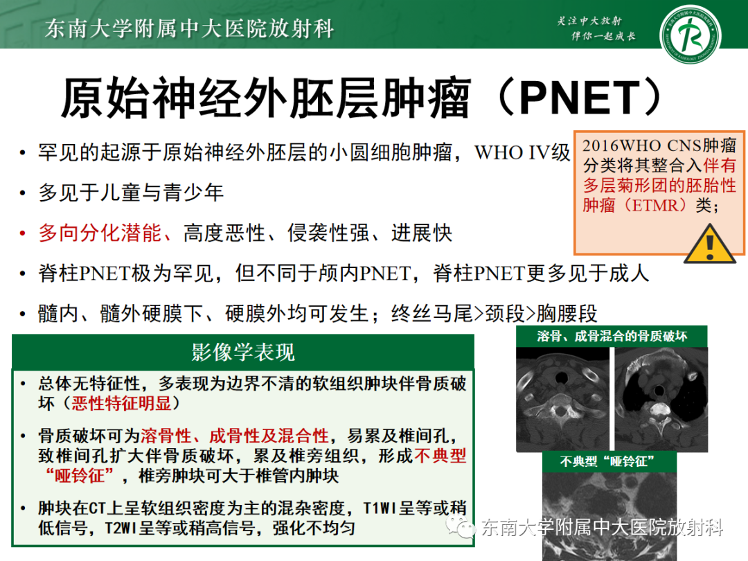 影像PPT - 【PPT】椎管内硬膜外间隙病变-40