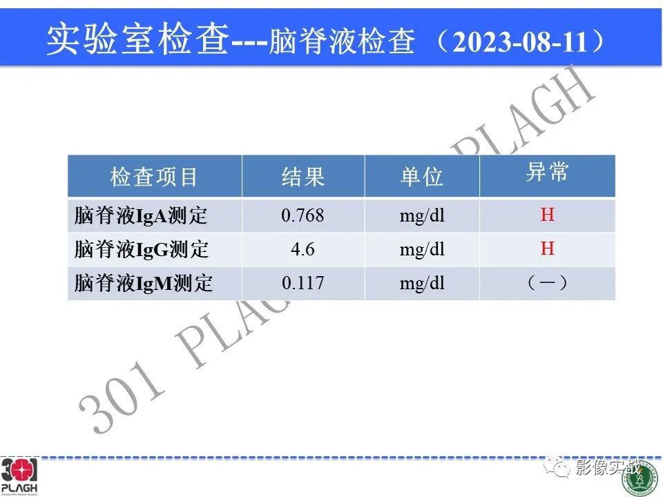 影像PPT - 【病例】髓鞘少突胶质细胞糖蛋白抗体相关疾病(MOG抗体相关疾病)-5