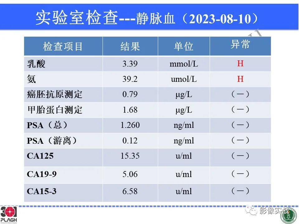 影像PPT - 【病例】髓鞘少突胶质细胞糖蛋白抗体相关疾病(MOG抗体相关疾病)-6