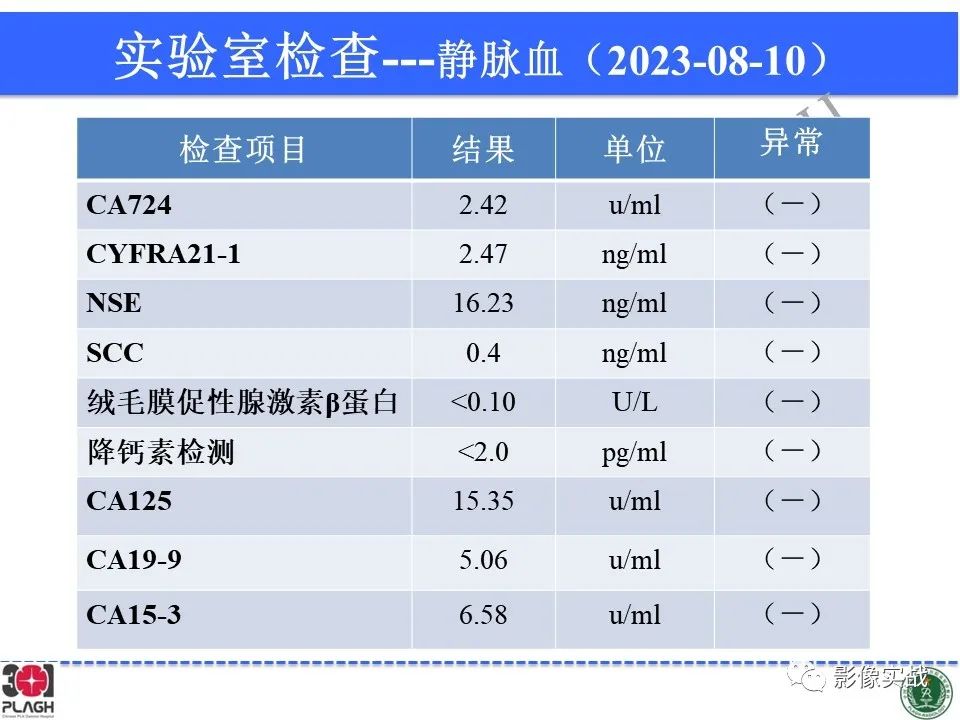 影像PPT - 【病例】髓鞘少突胶质细胞糖蛋白抗体相关疾病(MOG抗体相关疾病)-7