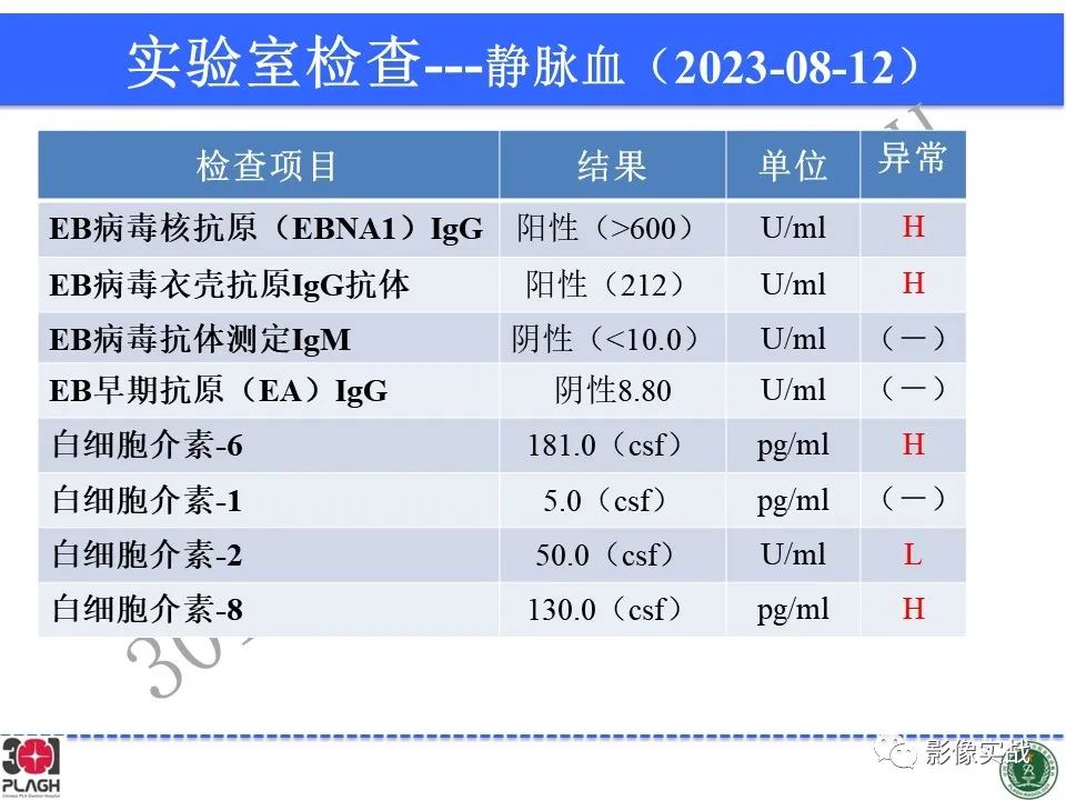 影像PPT - 【病例】髓鞘少突胶质细胞糖蛋白抗体相关疾病(MOG抗体相关疾病)-8