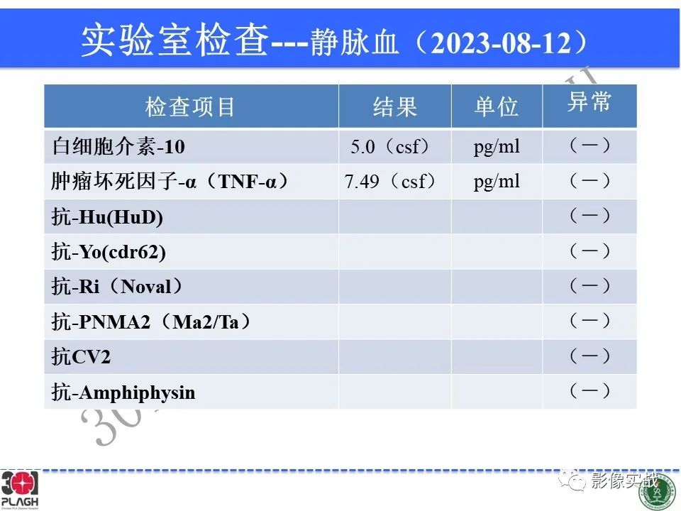 影像PPT - 【病例】髓鞘少突胶质细胞糖蛋白抗体相关疾病(MOG抗体相关疾病)-9
