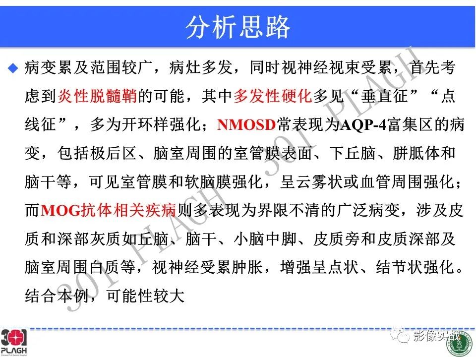 影像PPT - 【病例】髓鞘少突胶质细胞糖蛋白抗体相关疾病(MOG抗体相关疾病)-30