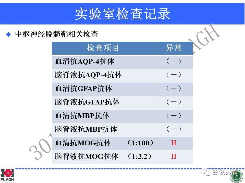 影像PPT - 【病例】髓鞘少突胶质细胞糖蛋白抗体相关疾病(MOG抗体相关疾病)-32