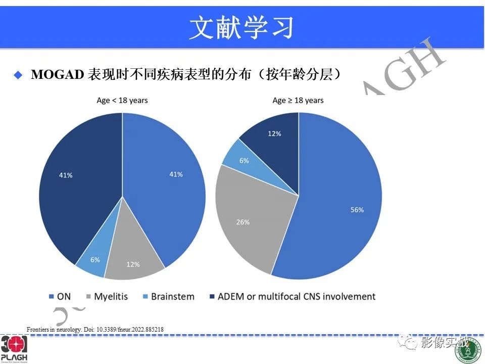 影像PPT - 【病例】髓鞘少突胶质细胞糖蛋白抗体相关疾病(MOG抗体相关疾病)-36