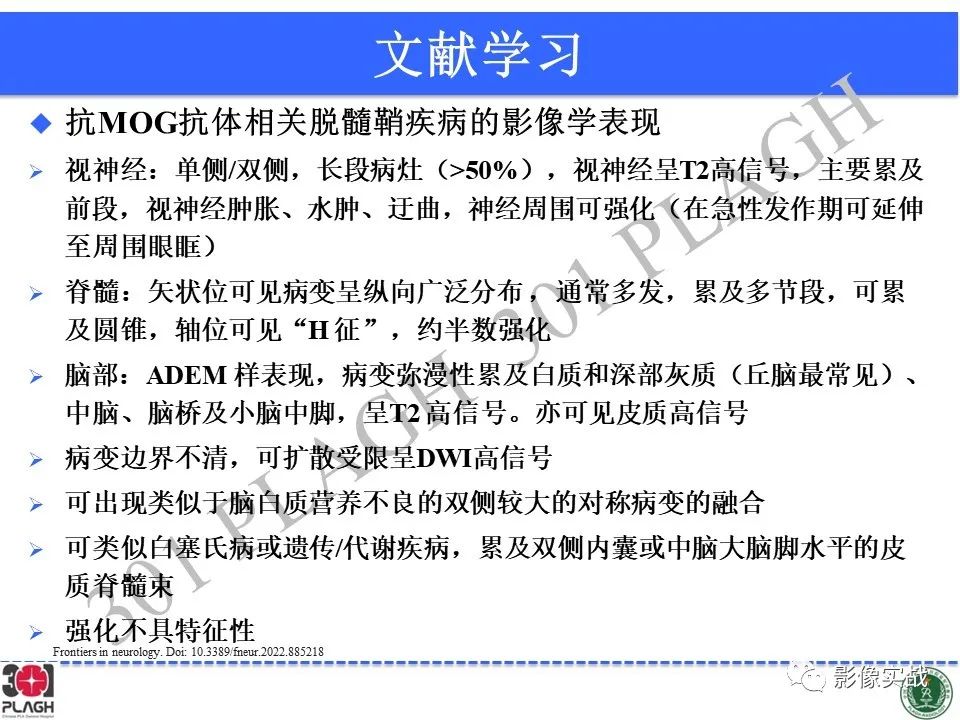 影像PPT - 【病例】髓鞘少突胶质细胞糖蛋白抗体相关疾病(MOG抗体相关疾病)-37