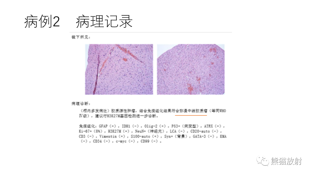 影像PPT - 【病例】急性坏死性脑病 VS 弥漫性中线胶质瘤-15