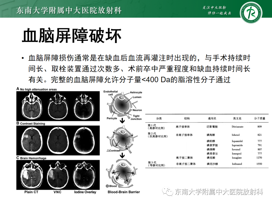 影像PPT - 【PPT】脑内出血和对比剂外渗鉴别—能谱CT的应用-7