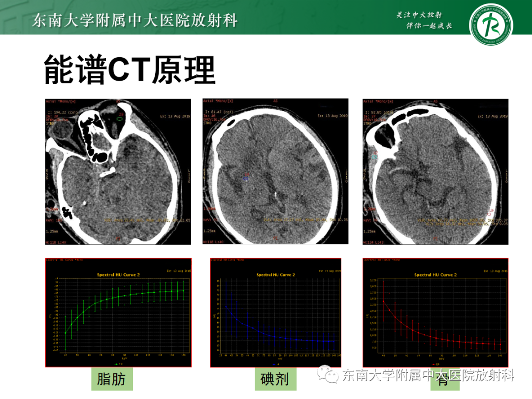 影像PPT - 【PPT】脑内出血和对比剂外渗鉴别—能谱CT的应用-13