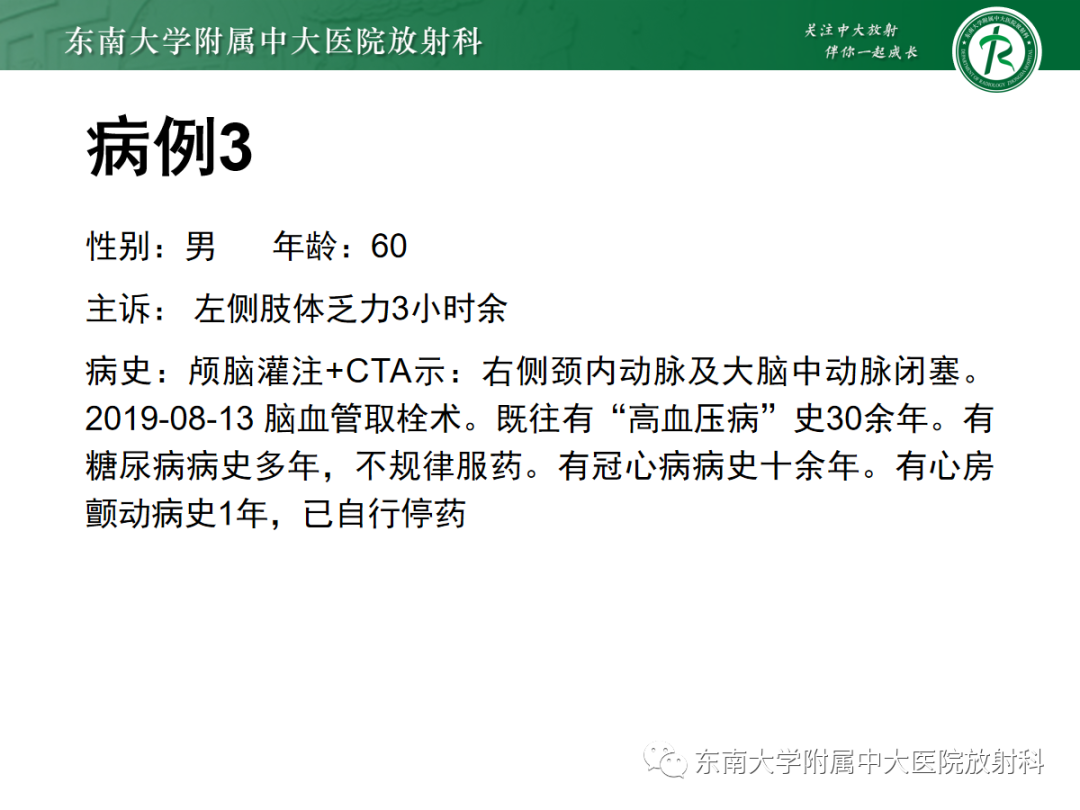 影像PPT - 【PPT】脑内出血和对比剂外渗鉴别—能谱CT的应用-22