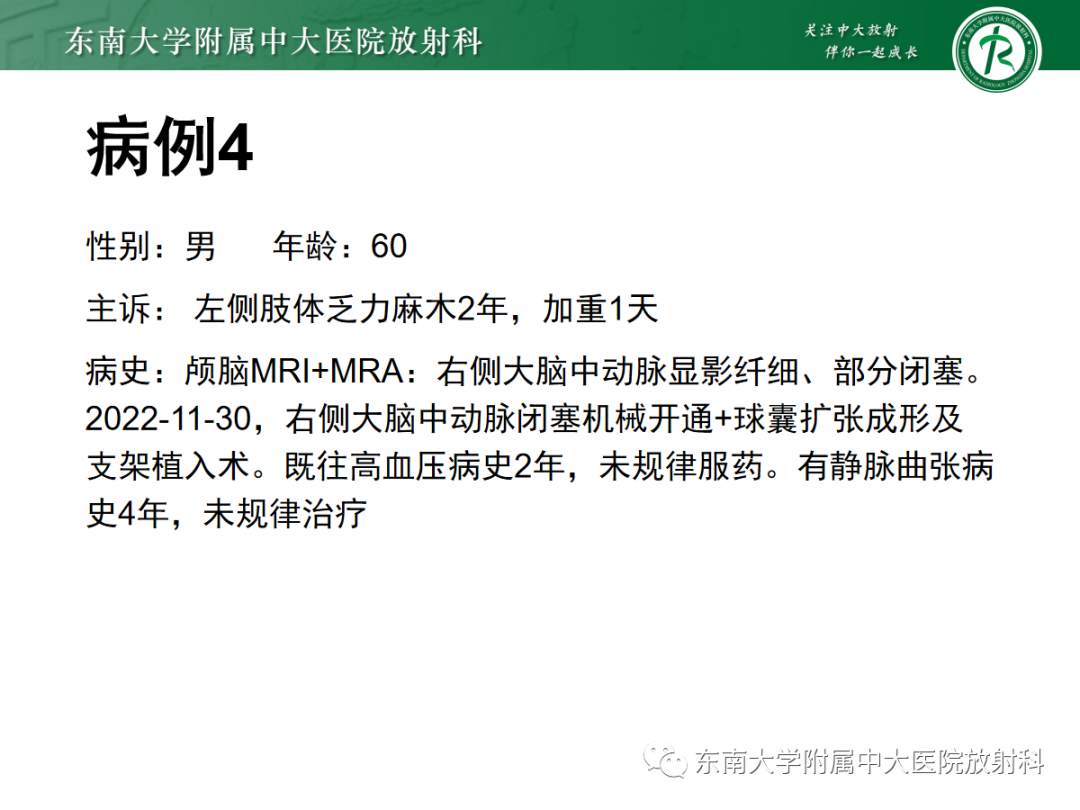 影像PPT - 【PPT】脑内出血和对比剂外渗鉴别—能谱CT的应用-28