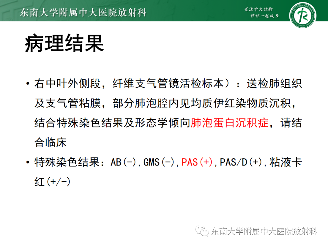 影像PPT - 【PPT】肺泡蛋白沉积症-4