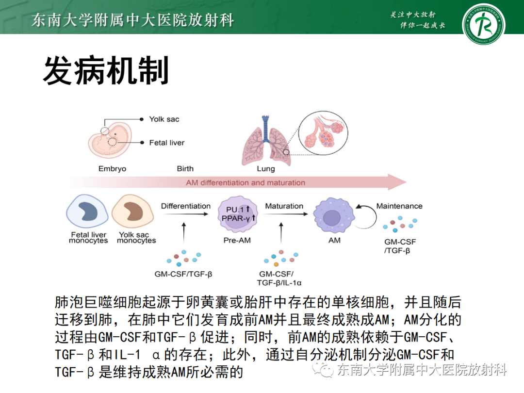 影像PPT - 【PPT】肺泡蛋白沉积症-9