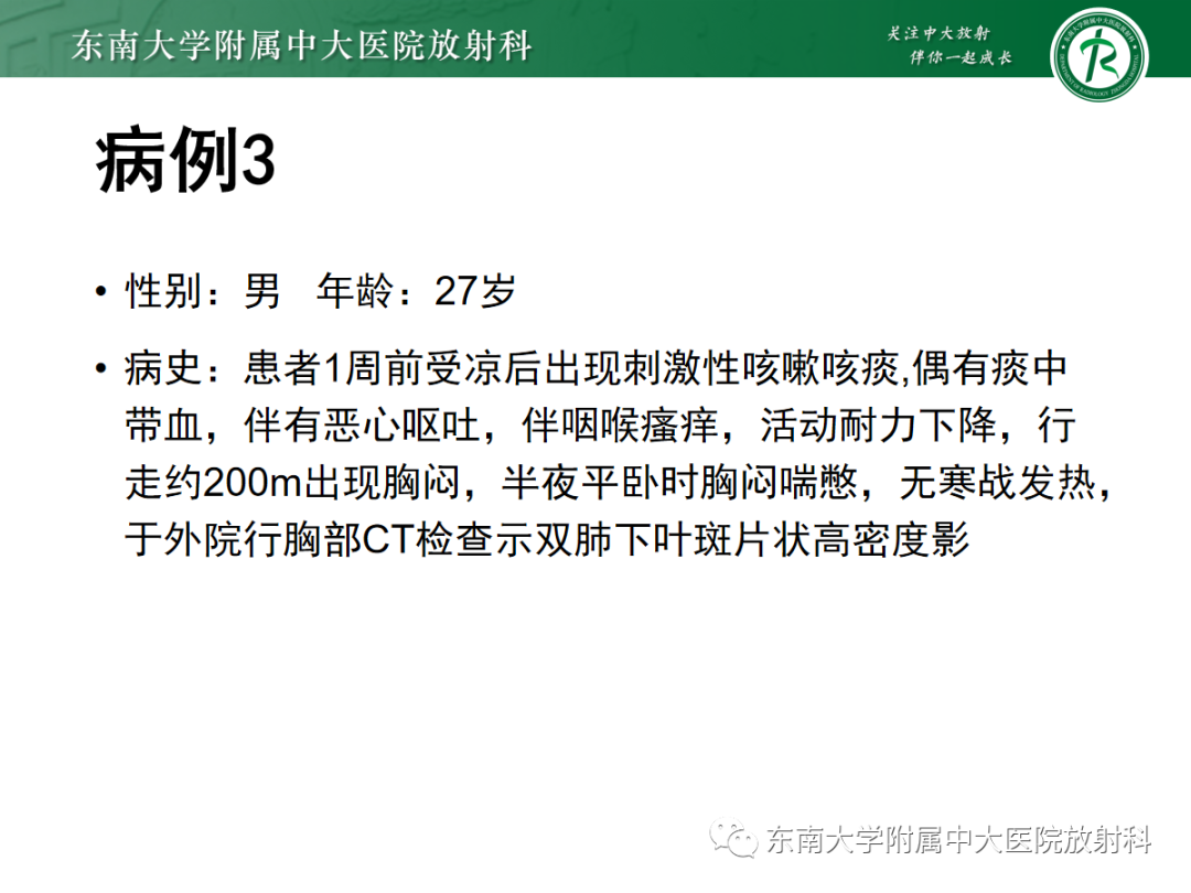 影像PPT - 【PPT】肺泡蛋白沉积症-24