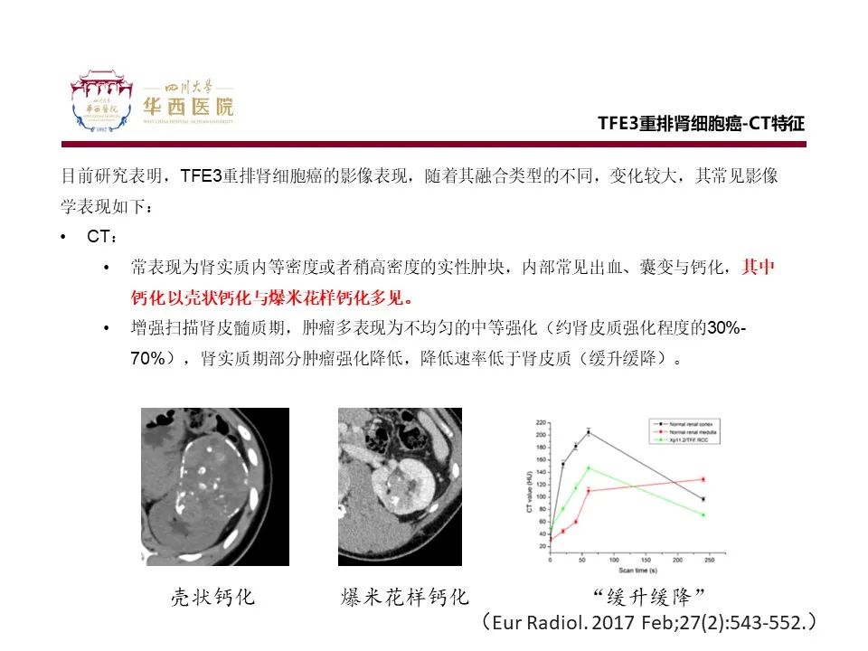 影像PPT - 【病例】TFE3重排肾细胞癌1例CT影像-8