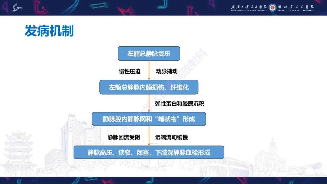 影像PPT - 【PPT】髂静脉压迫综合征影像诊断-15