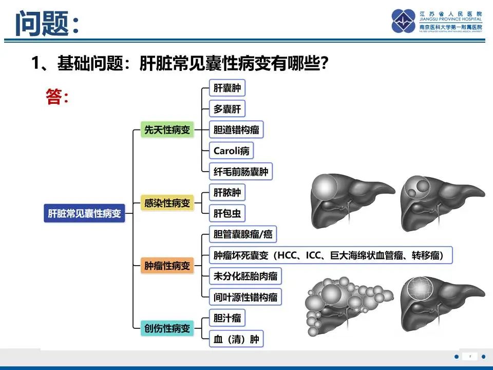 影像PPT - 【PPT】肝未分化胚胎肉瘤-8