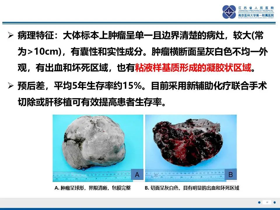 影像PPT - 【PPT】肝未分化胚胎肉瘤-18