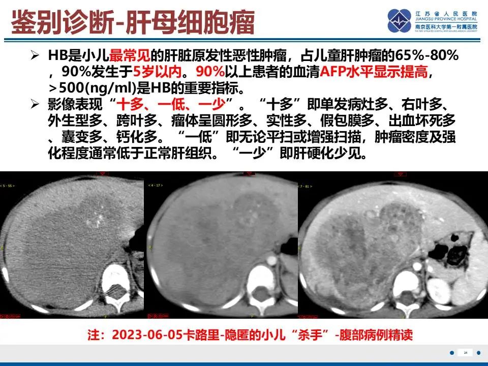 影像PPT - 【PPT】肝未分化胚胎肉瘤-25