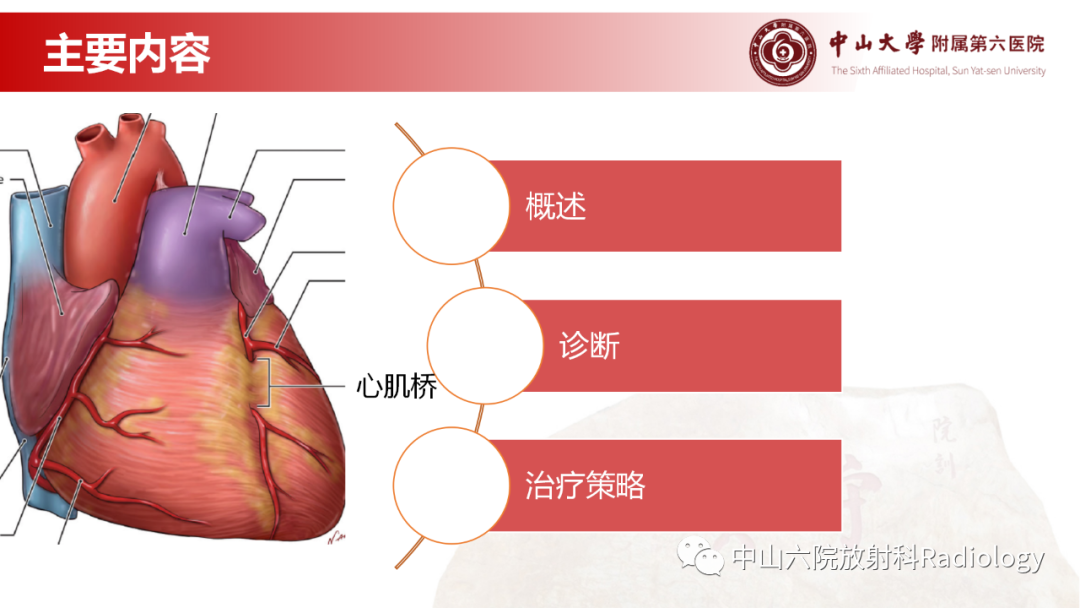 影像PPT - 【PPT】心肌桥的分型及影像诊断-4