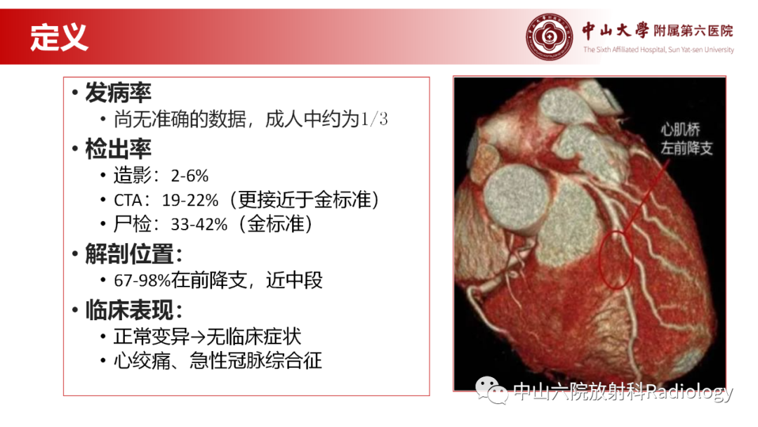 影像PPT - 【PPT】心肌桥的分型及影像诊断-6