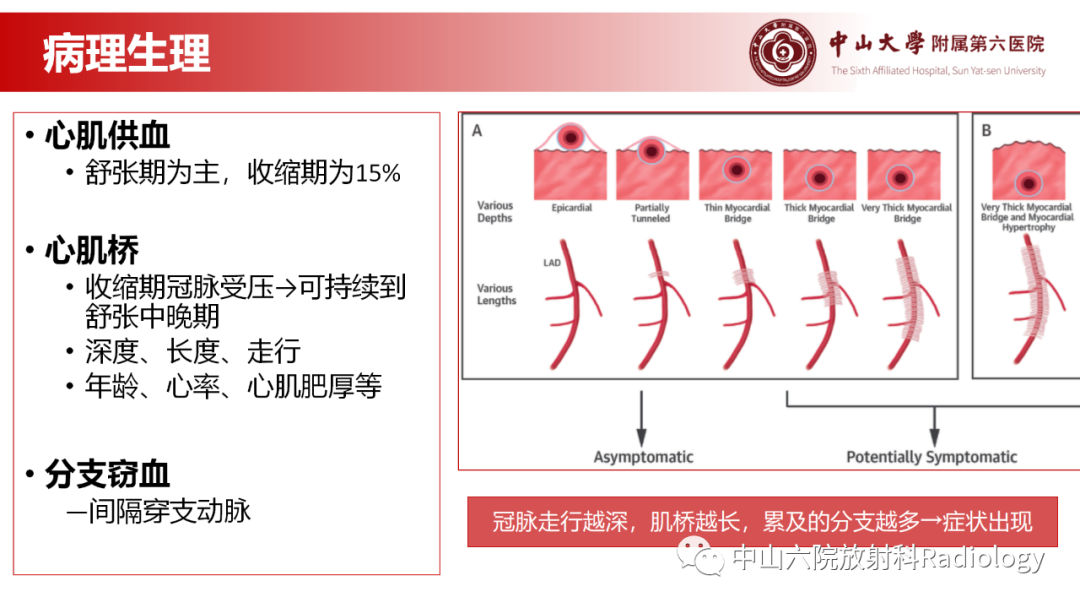 影像PPT - 【PPT】心肌桥的分型及影像诊断-7