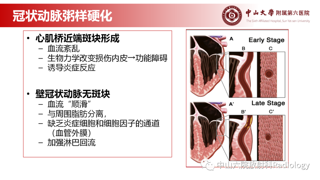 影像PPT - 【PPT】心肌桥的分型及影像诊断-9