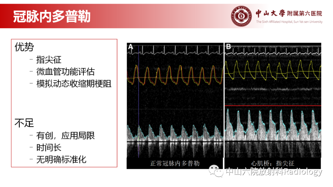 影像PPT - 【PPT】心肌桥的分型及影像诊断-14