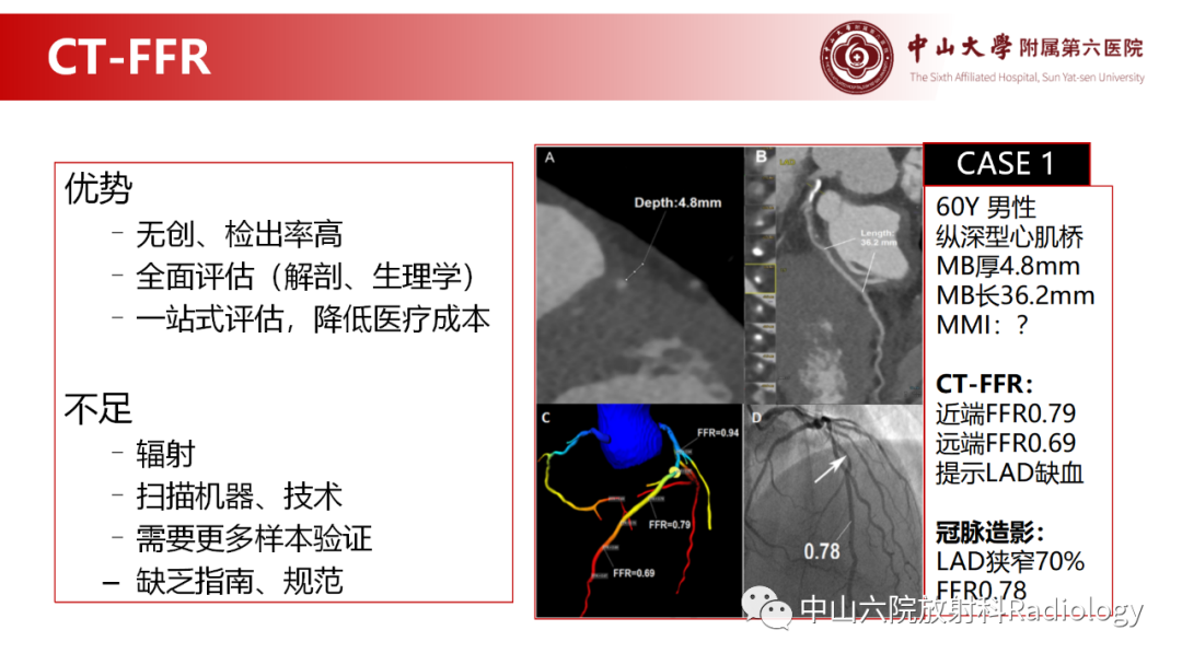 影像PPT - 【PPT】心肌桥的分型及影像诊断-18