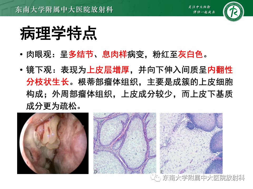 影像PPT - 【PPT】鼻腔鼻窦内翻性乳头状瘤-8