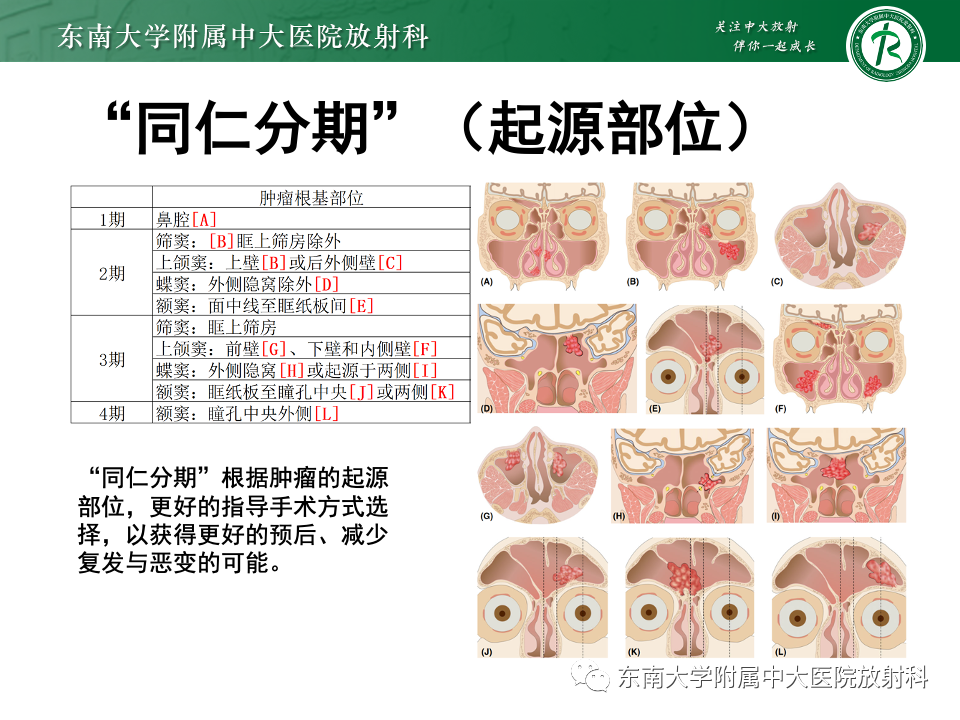 影像PPT - 【PPT】鼻腔鼻窦内翻性乳头状瘤-11