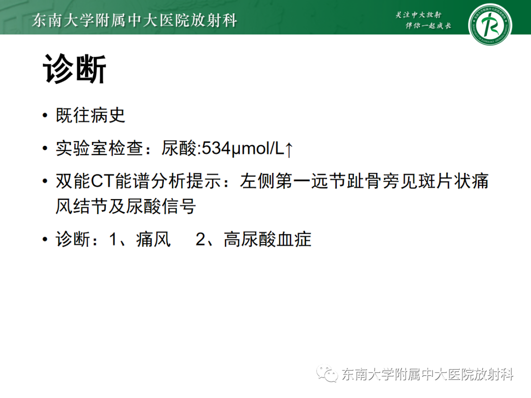 影像PPT - 【PPT】痛风的影像学评估-3 影像PPT - 【PPT】痛风的影像学评估-3
