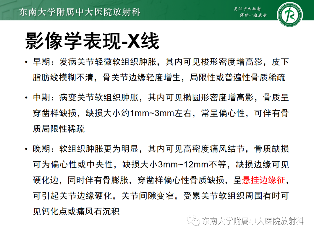 影像PPT - 【PPT】痛风的影像学评估-17 影像PPT - 【PPT】痛风的影像学评估-17