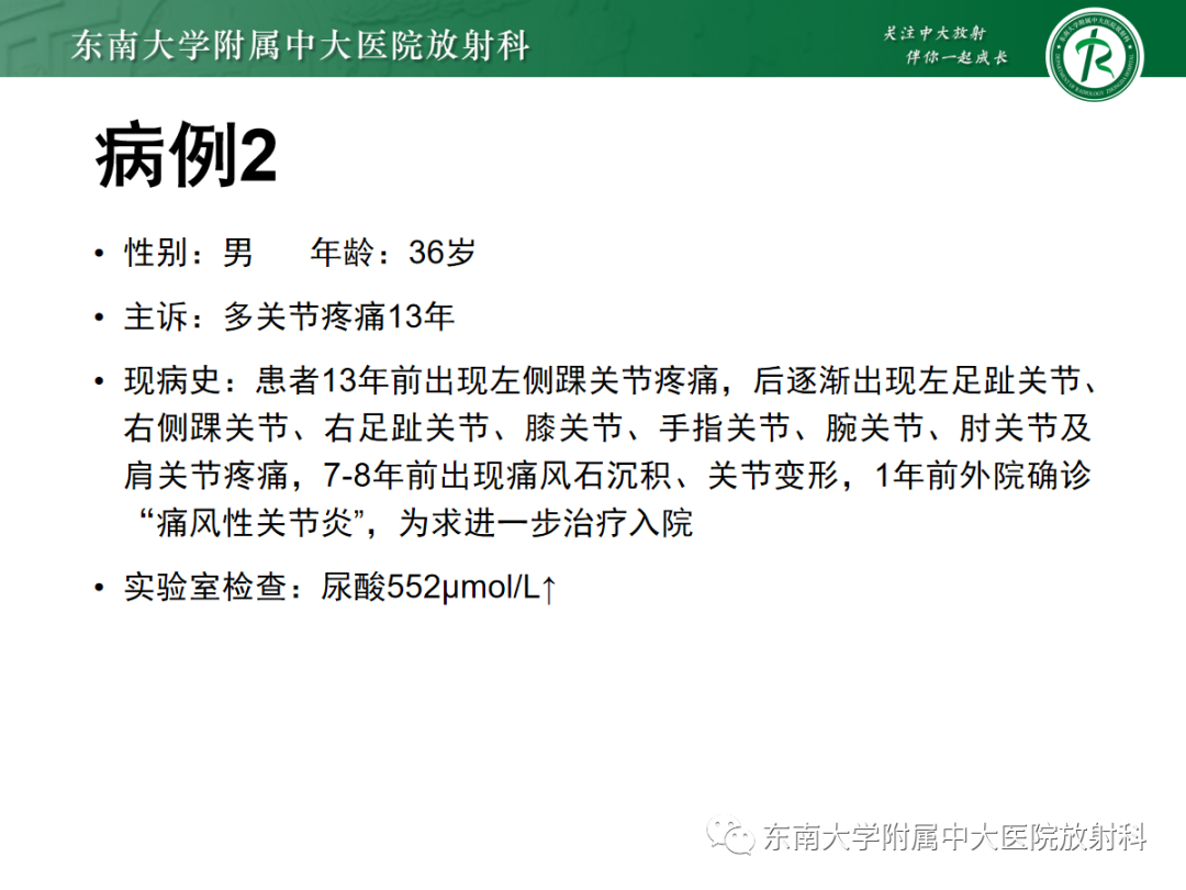 影像PPT - 【PPT】痛风的影像学评估-20 影像PPT - 【PPT】痛风的影像学评估-20