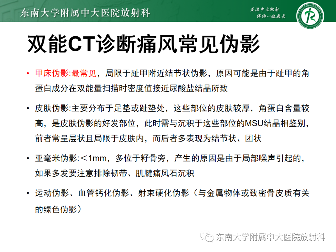 影像PPT - 【PPT】痛风的影像学评估-29 影像PPT - 【PPT】痛风的影像学评估-29