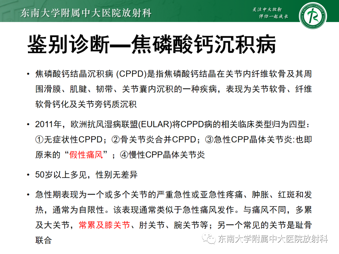 影像PPT - 【PPT】痛风的影像学评估-31 影像PPT - 【PPT】痛风的影像学评估-31