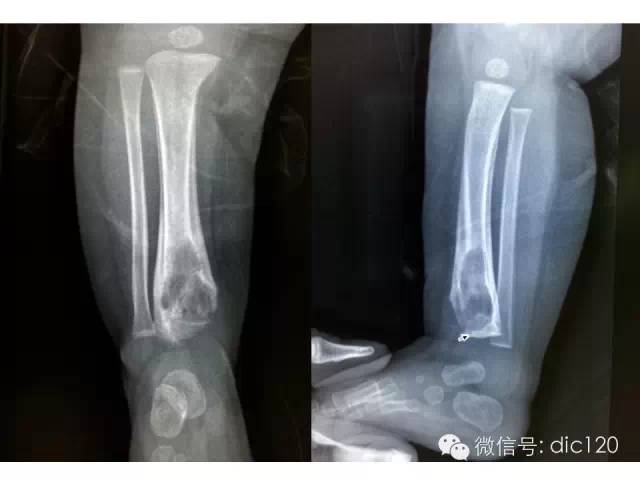 影像PPT - \