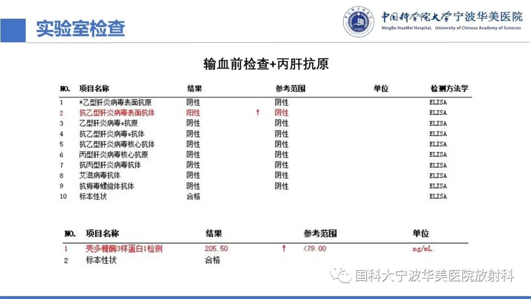 影像PPT - 【PPT】原发性肝脏神经内分泌肿瘤-5