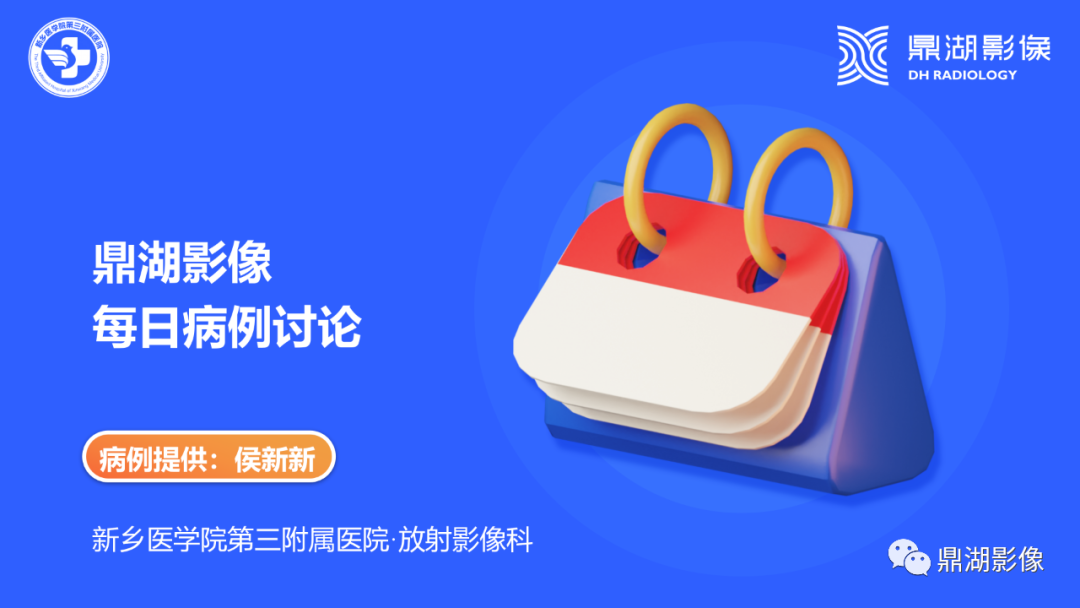 影像PPT - 【病例】胰腺实性假乳头状瘤1例CT及MR影像-1 影像PPT - 【病例】胰腺实性假乳头状瘤1例CT及MR影像-1