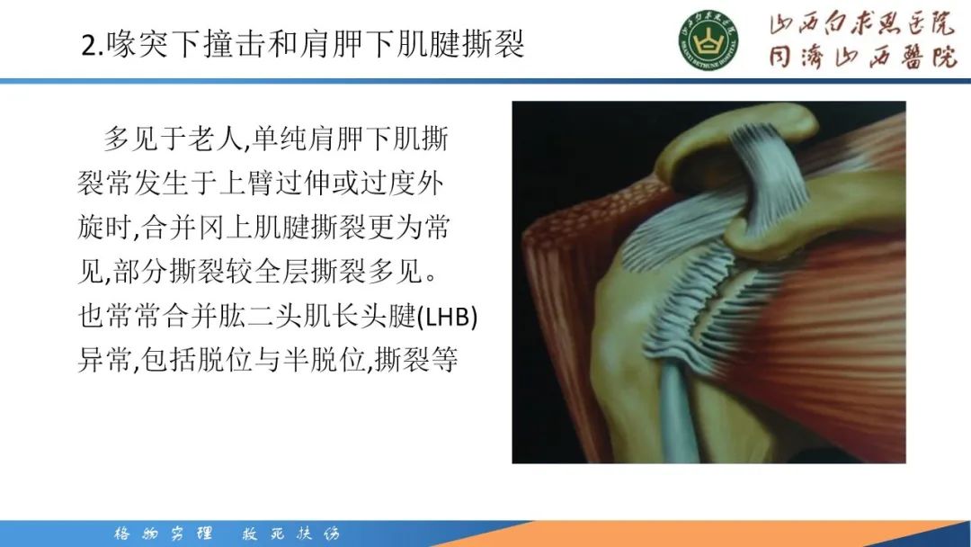 影像PPT - 【PPT】肩关节损伤的MRI表现-20