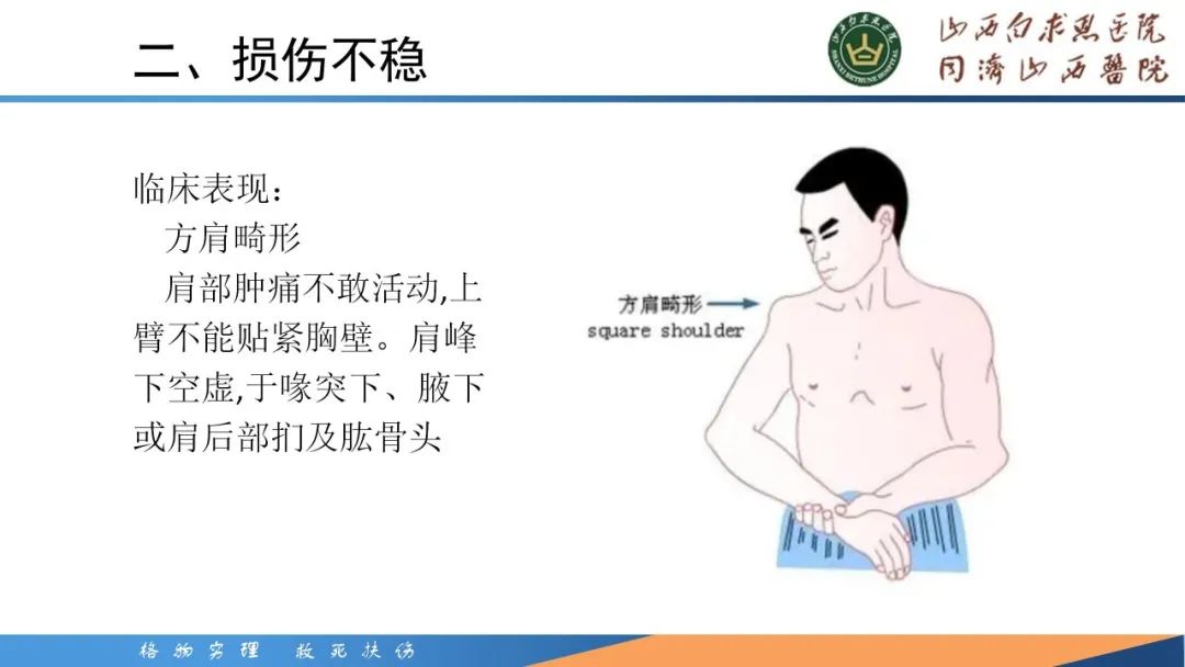 影像PPT - 【PPT】肩关节损伤的MRI表现-26