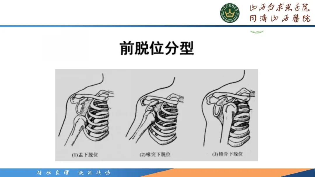影像PPT - 【PPT】肩关节损伤的MRI表现-27
