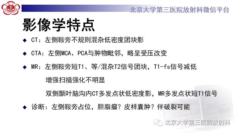 影像PPT - 【PPT】鞍旁表皮样囊肿/胆脂瘤-9