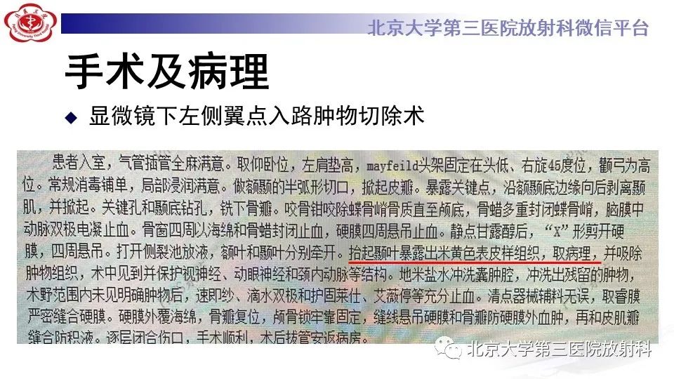 影像PPT - 【PPT】鞍旁表皮样囊肿/胆脂瘤-10