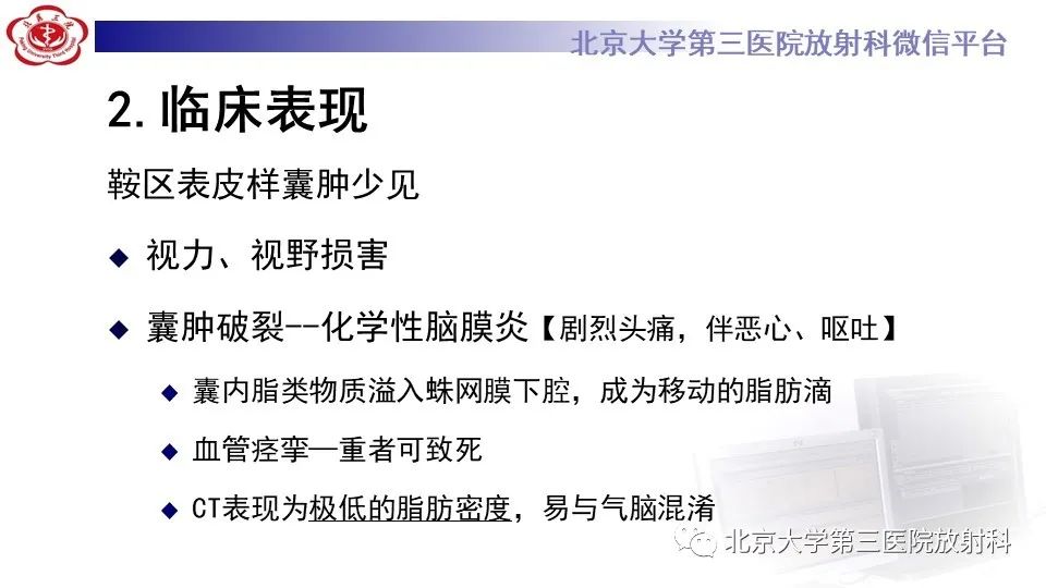 影像PPT - 【PPT】鞍旁表皮样囊肿/胆脂瘤-14