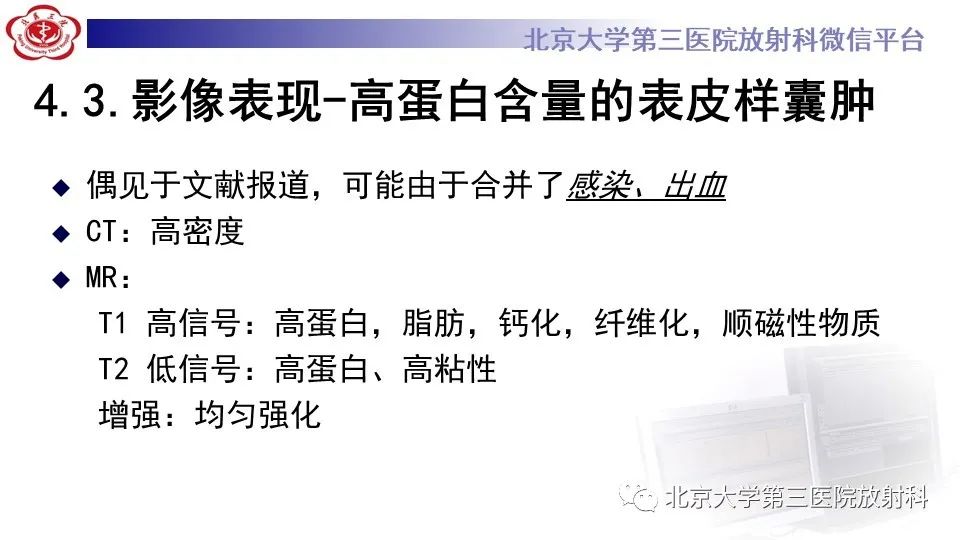 影像PPT - 【PPT】鞍旁表皮样囊肿/胆脂瘤-23
