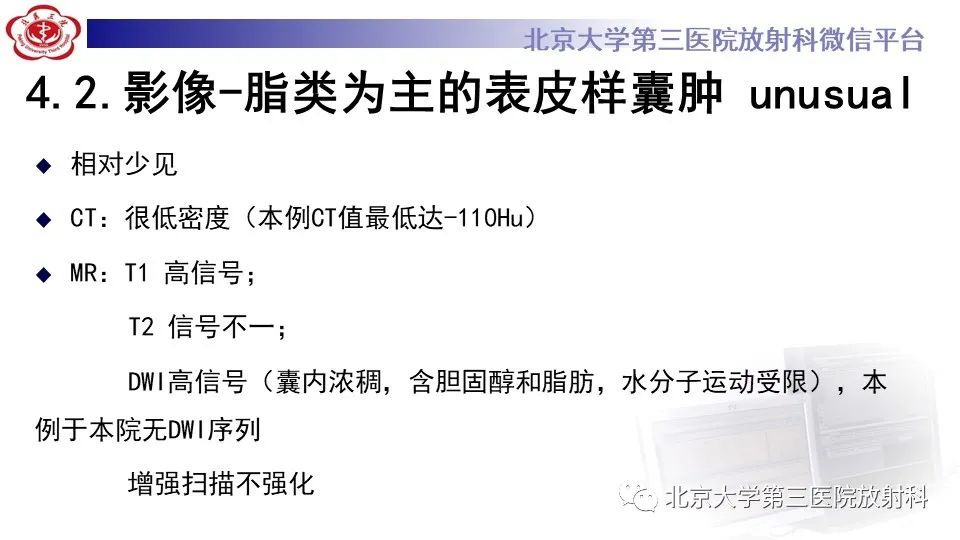 影像PPT - 【PPT】鞍旁表皮样囊肿/胆脂瘤-22